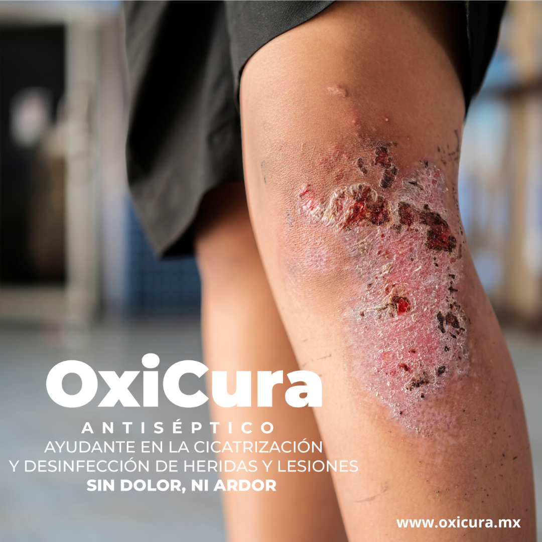 Sin dolor ni ardor OxiCura antiséptico