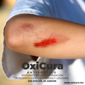 Sin dolor ni ardor OxiCura antiséptico