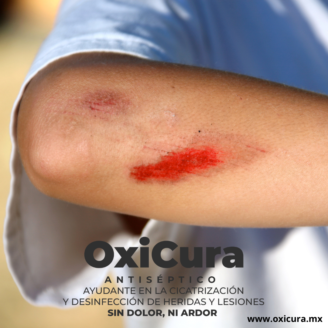 Sin dolor ni ardor OxiCura antiséptico
