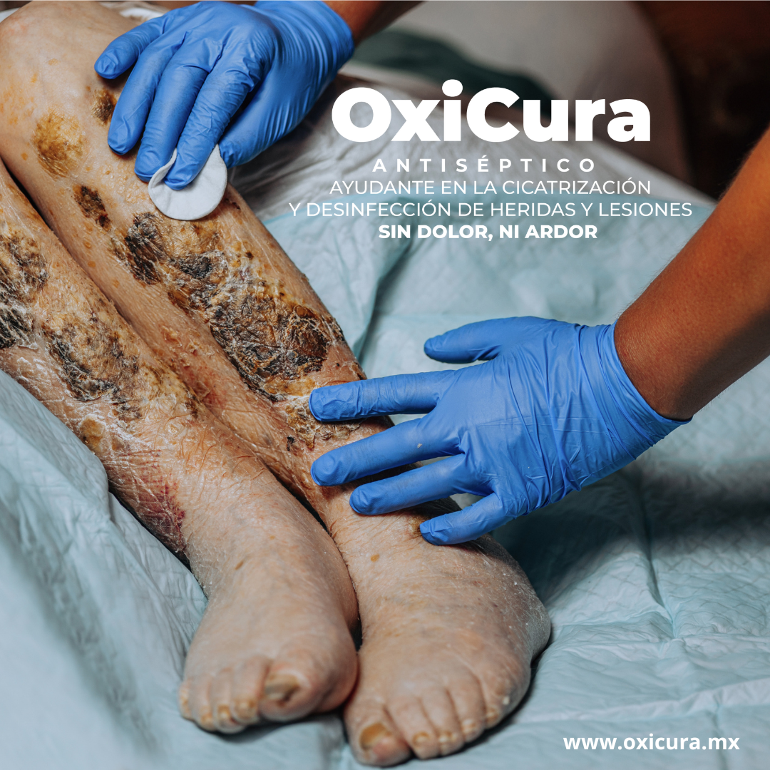 Sin dolor ni ardor OxiCura antiséptico